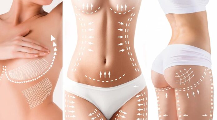 Telo posle porođaja: Kada vežbe i dijeta nisu dovoljne – vreme je za Mommy Makeover Telo posle porođaja: Kada vežbe i dijeta nisu dovoljne – vreme je za Mommy Makeover